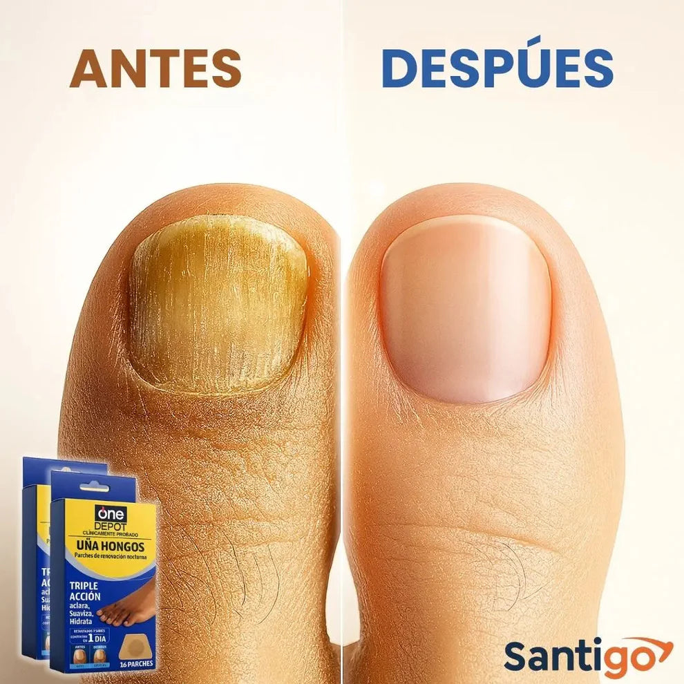 32 Parches AntiHongos | Uñas Visiblemente Más Sanas en Pocos Dias