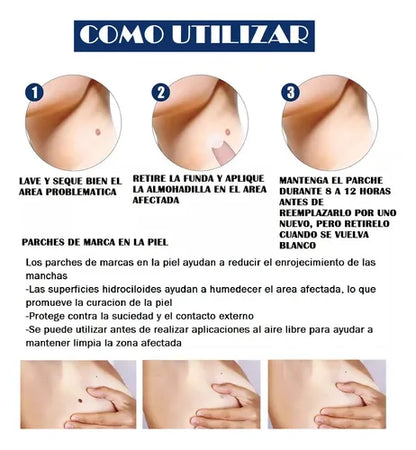 FormuClear Parches – Remueve Verrugas Fácil – Recupera tu confianza sin dolor en casa